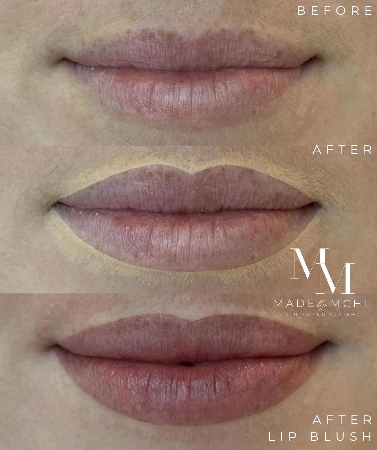 Lip blush before, shaping and after result at MADEBYMCHL