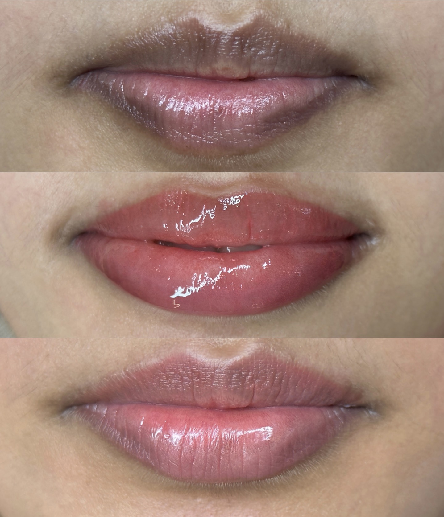 Lip blush before, fresh glossy result and healed natural colour