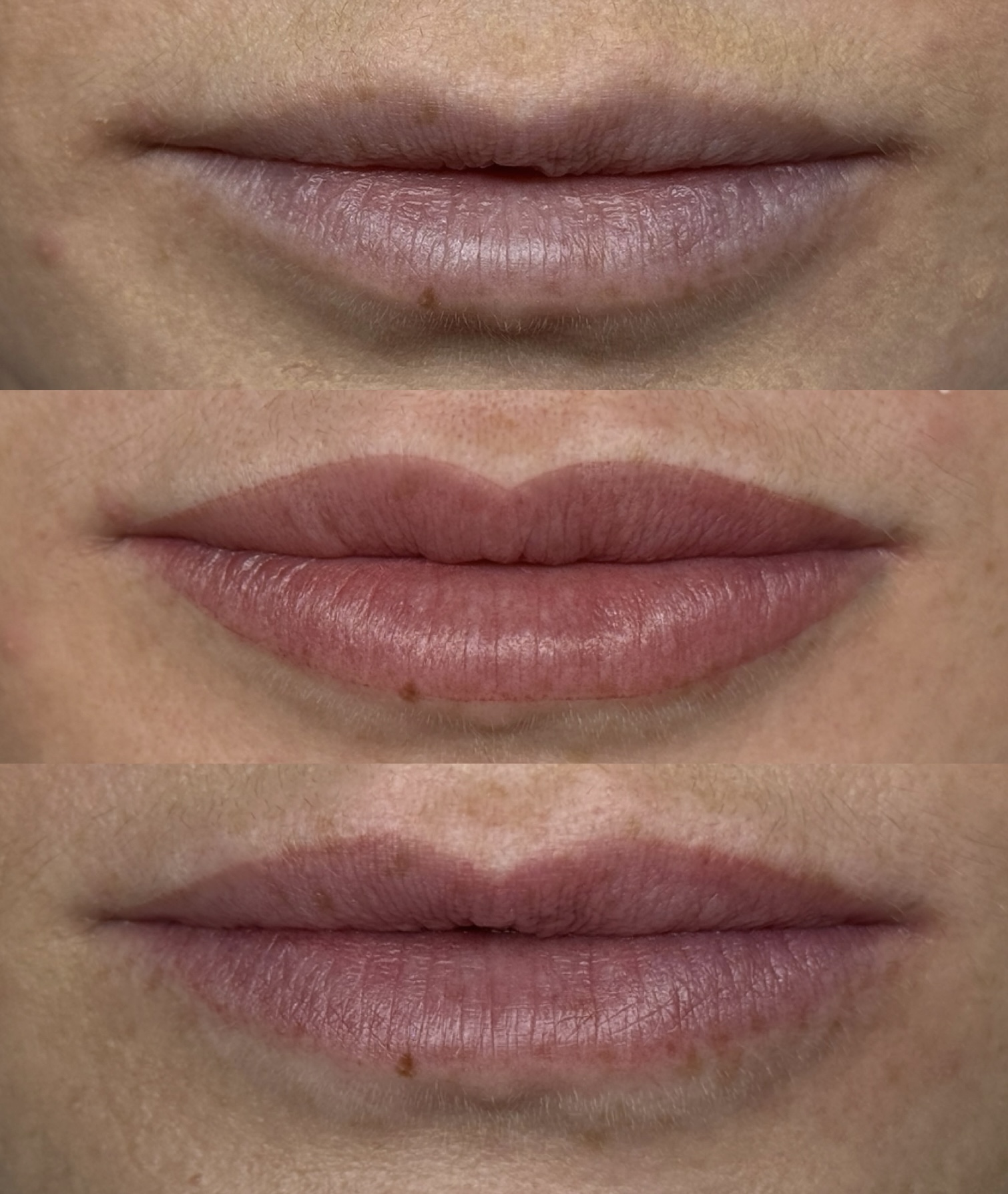 Lip blush before, defined after result and softly healed colour