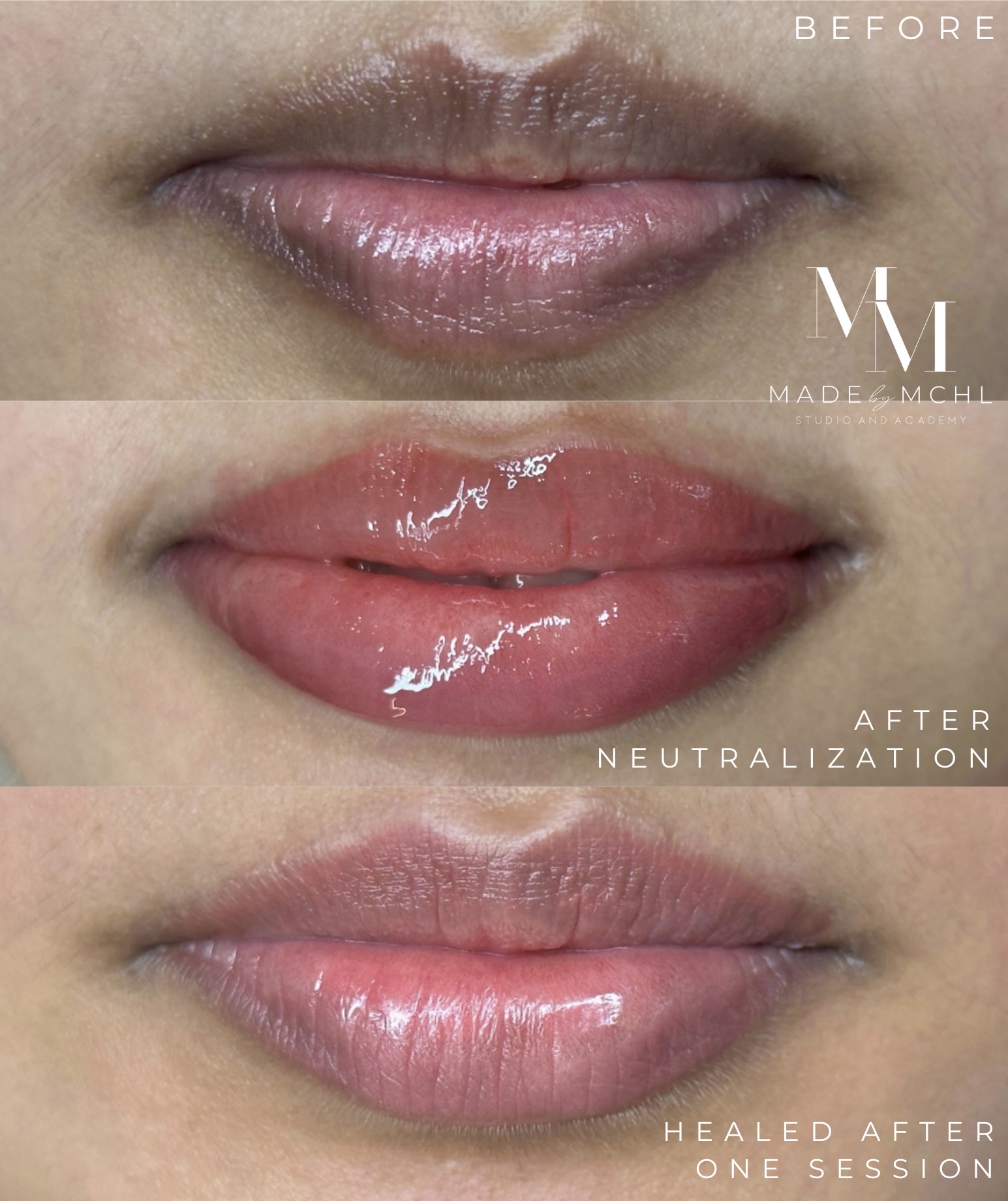 Before, after neutralization and healed lip blush result